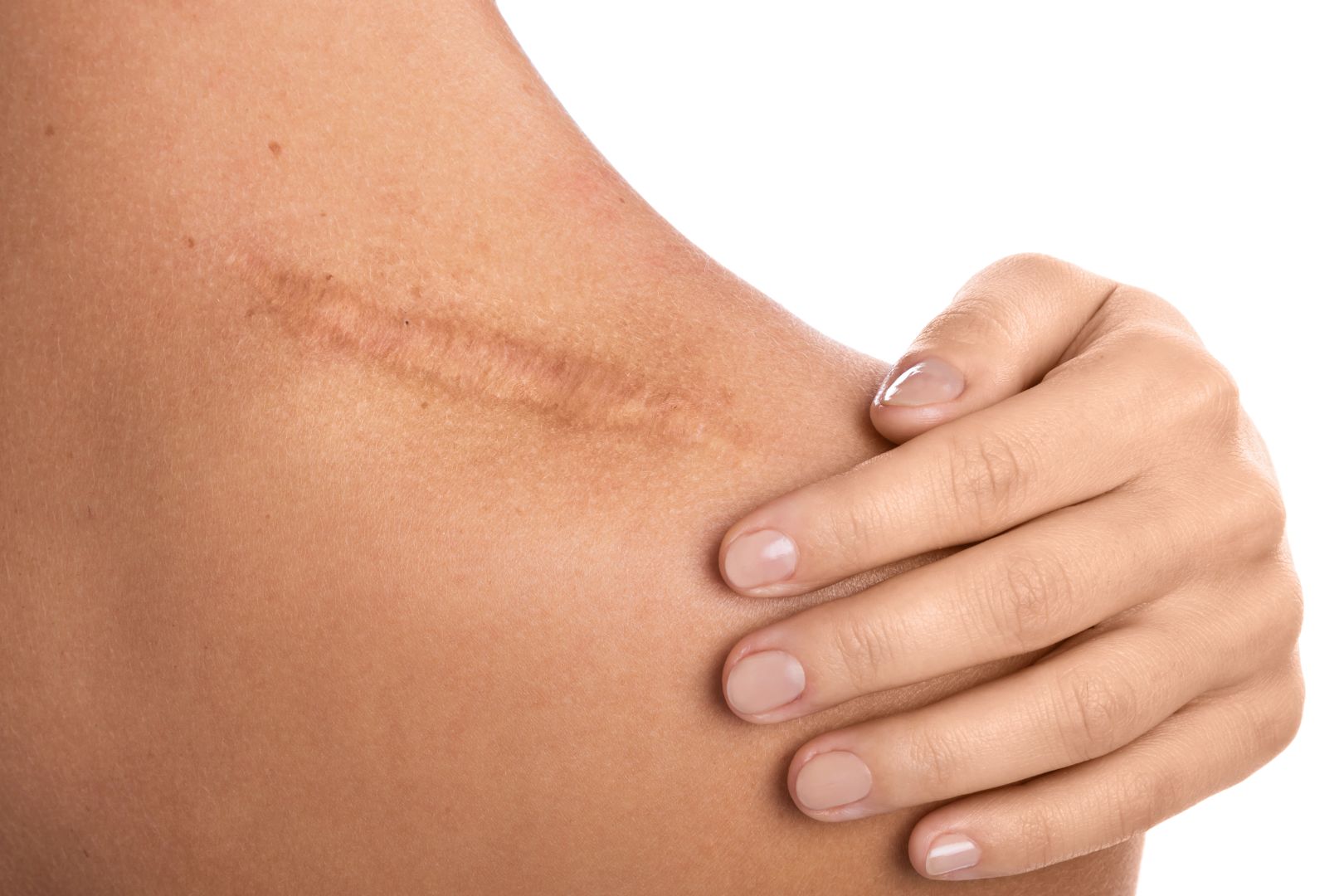 Revive Collagen vs Benjamin Button: 