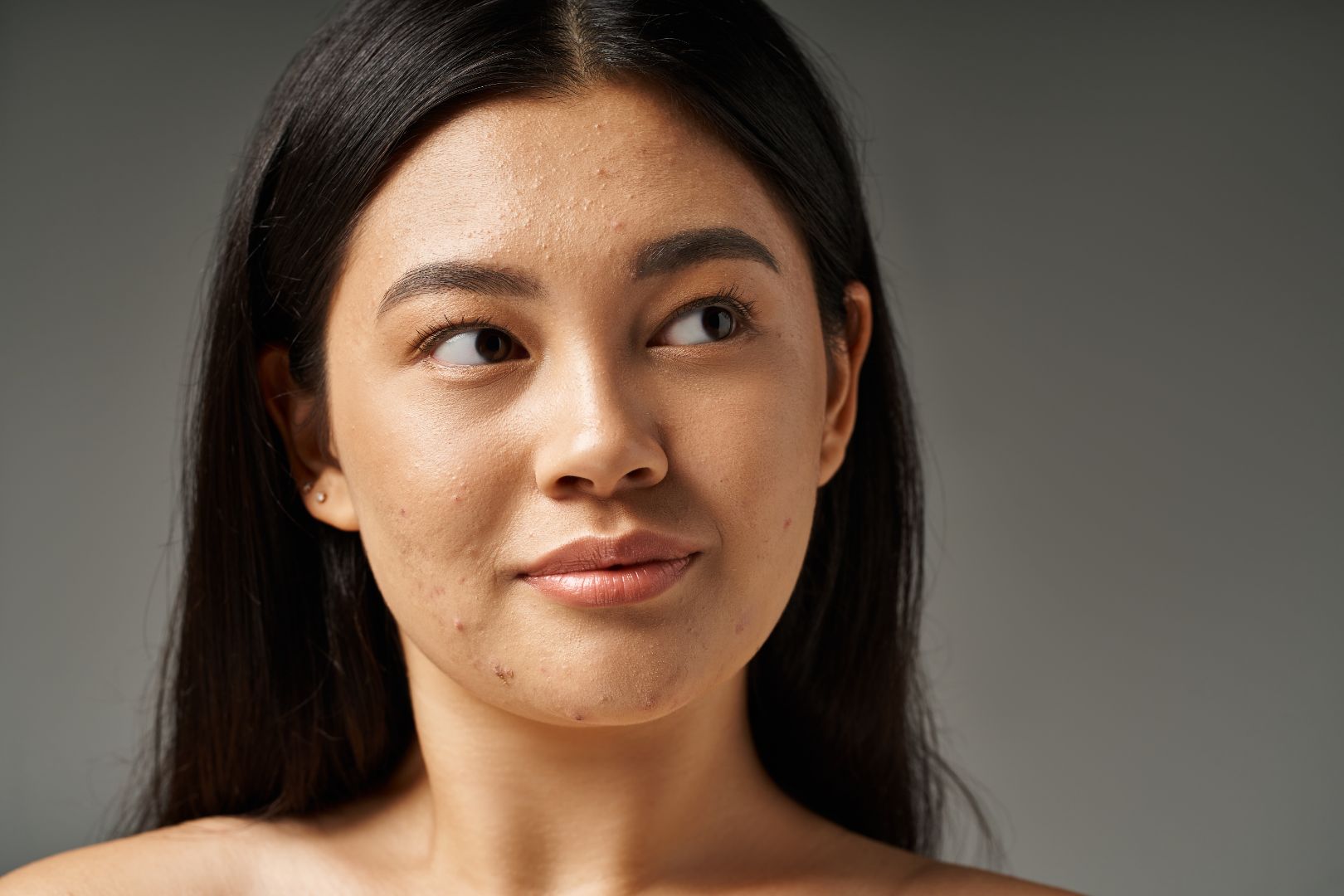 anua dark spot correcting serum